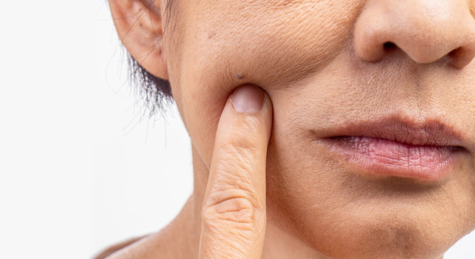 Ozempic Face Explained Keep Your Skin Firm And Fabulous With Simple Skincare Solutions Ozempic Face Explained Keep Your Skin Firm And Fabulous With Simple Skincare Solutions