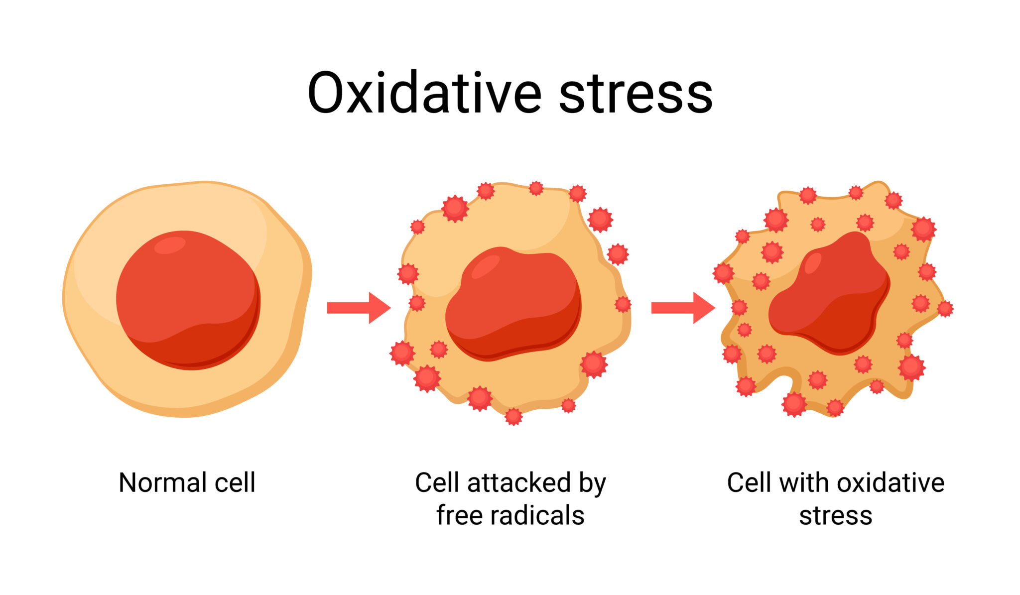 Illustration showing how a healthy cell becomes damaged by free radicals, leading to oxidative stress